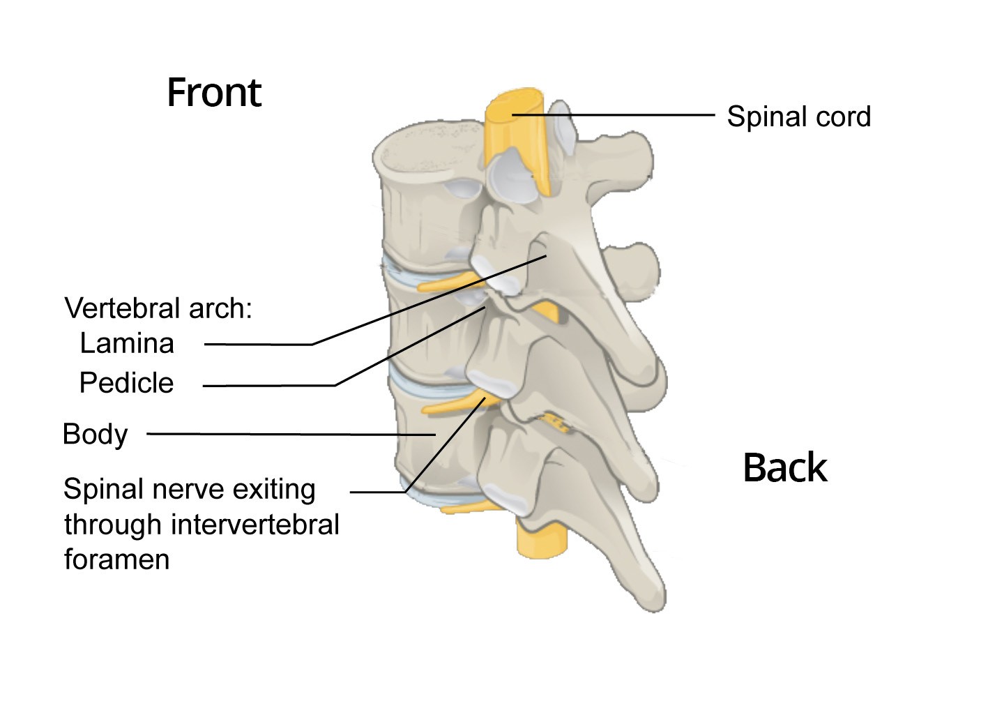 Severe Leg Pain after Spinal Fusion Causes & Solutions
